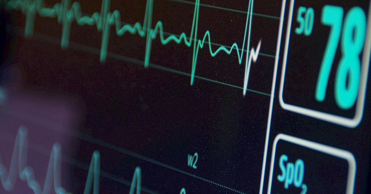 ECG heart monitor screen