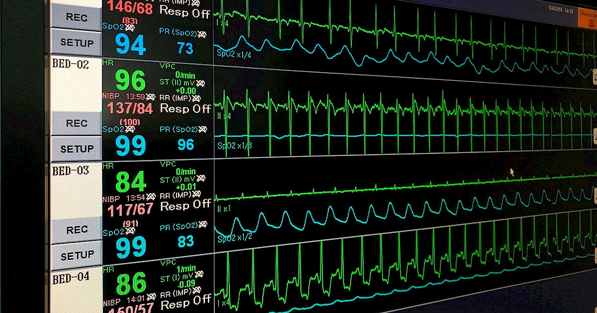 Vital sign ekg monitor, EKG monitor of patient in hospital. Telemetry system.